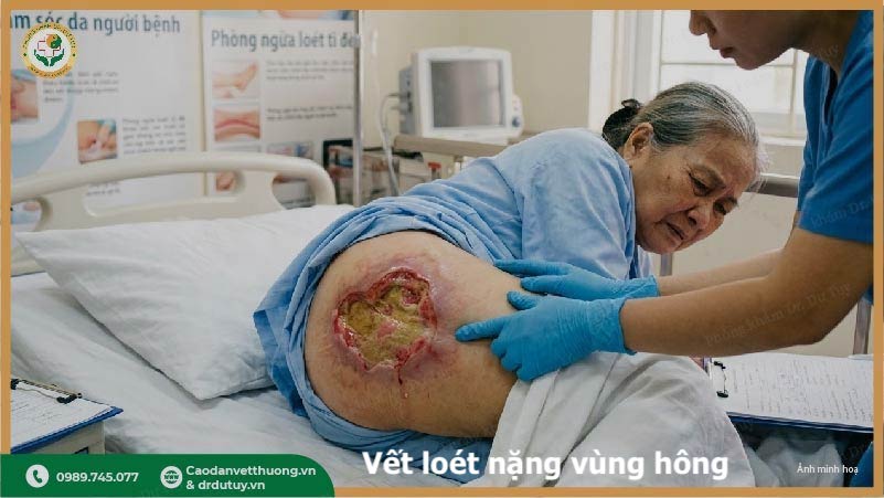 loet-da-nang-o-nguoi-nam-lau (1)